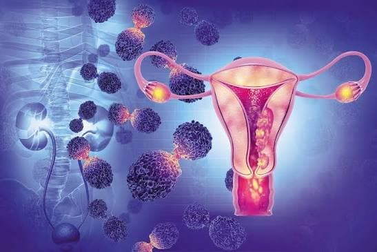 Gynecological - Radiation Oncology Care by Dr. Sarthak Kumar Mohanty in Rajkot, Gujarat